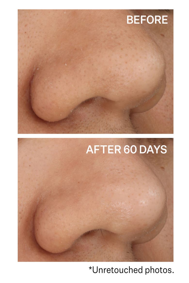 Daily Reveal™ Exfoliating Pads, Alternate, color, NO COLOR