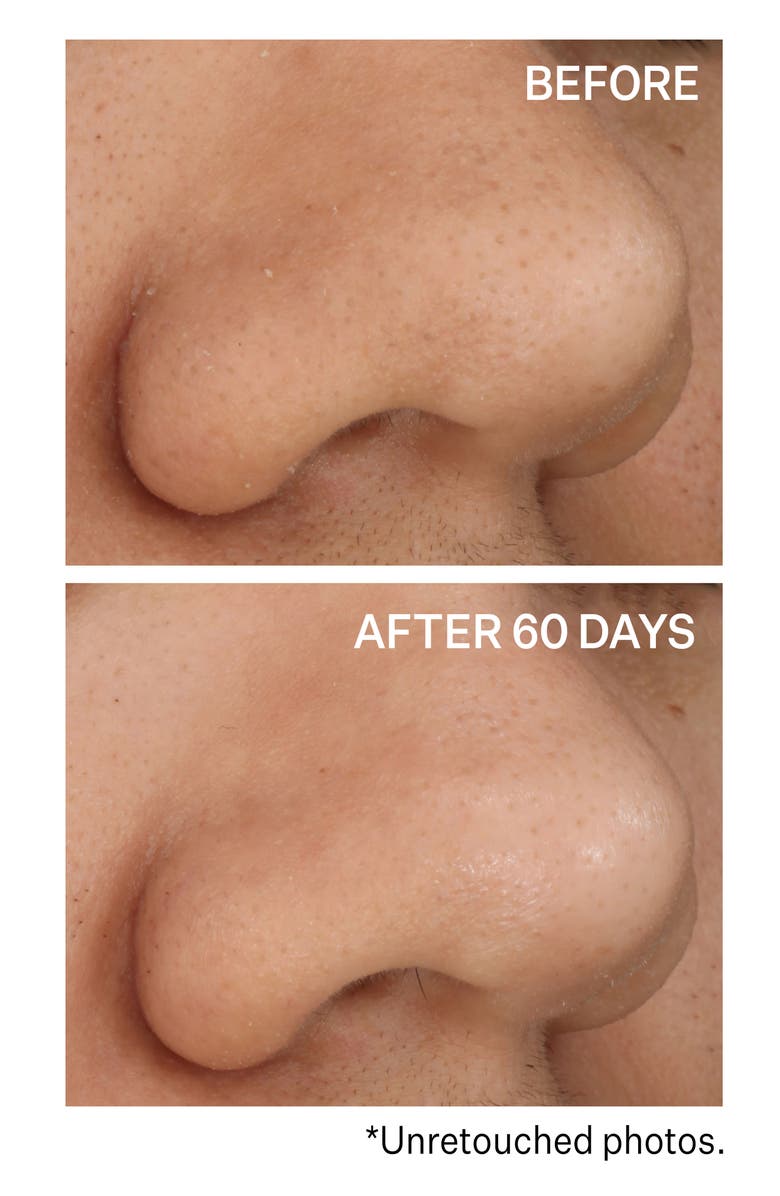 StriVectin<sup>®</sup> Daily Reveal<sup>™</sup> Exfoliating Pads, Alternate, color,