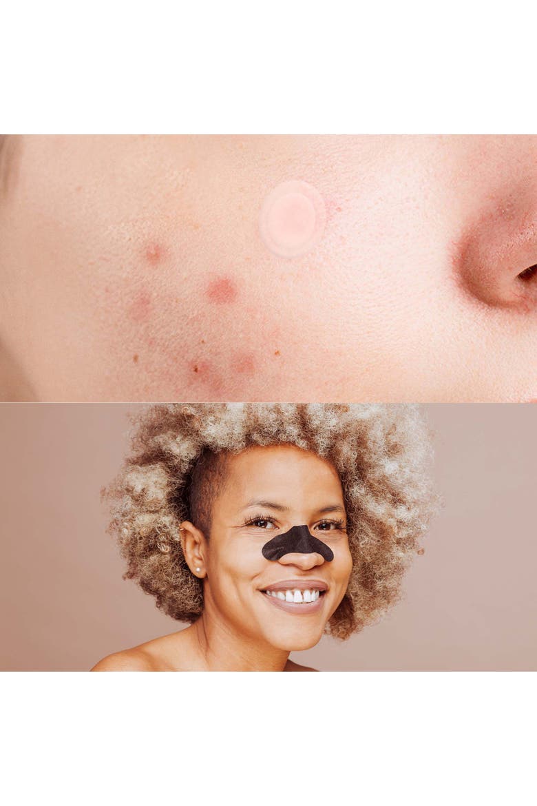 Deep Cleansing Charcoal Nose Pore Strip 6-Pack & Hydrocolloid Pimple Patch, 120-Count, Alternate, color, Black and White