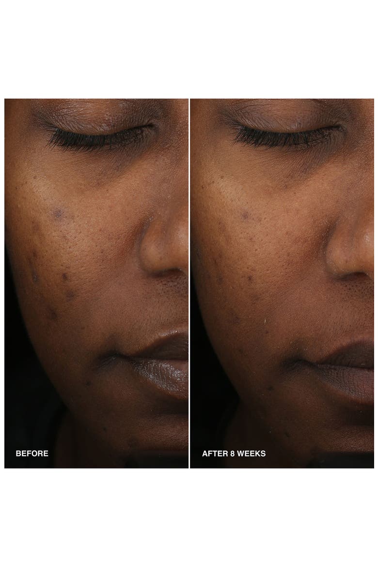Vitamin Enriched Smoothing Niacinamide + Vitamin C Serum, Alternate, color, NO COLOR