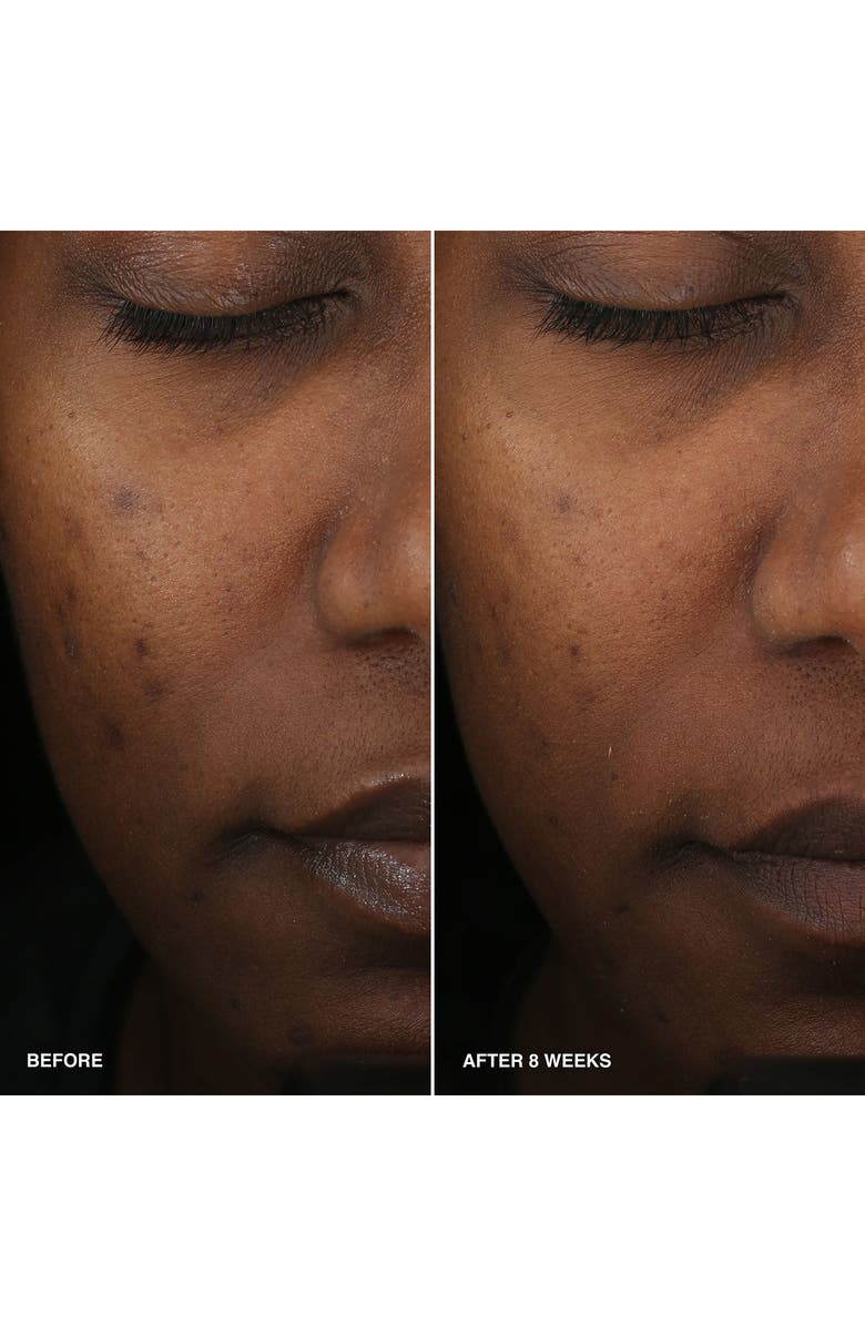 Bobbi Brown Vitamin Enriched Smoothing Niacinamide + Vitamin C Serum, Alternate, color,