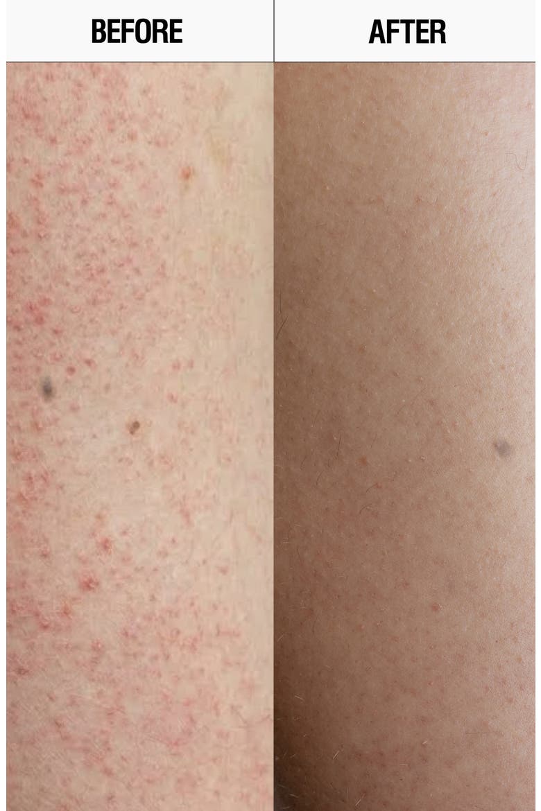Resurfacing Targeted Body Cleanser, Alternate, color, NO COLOR