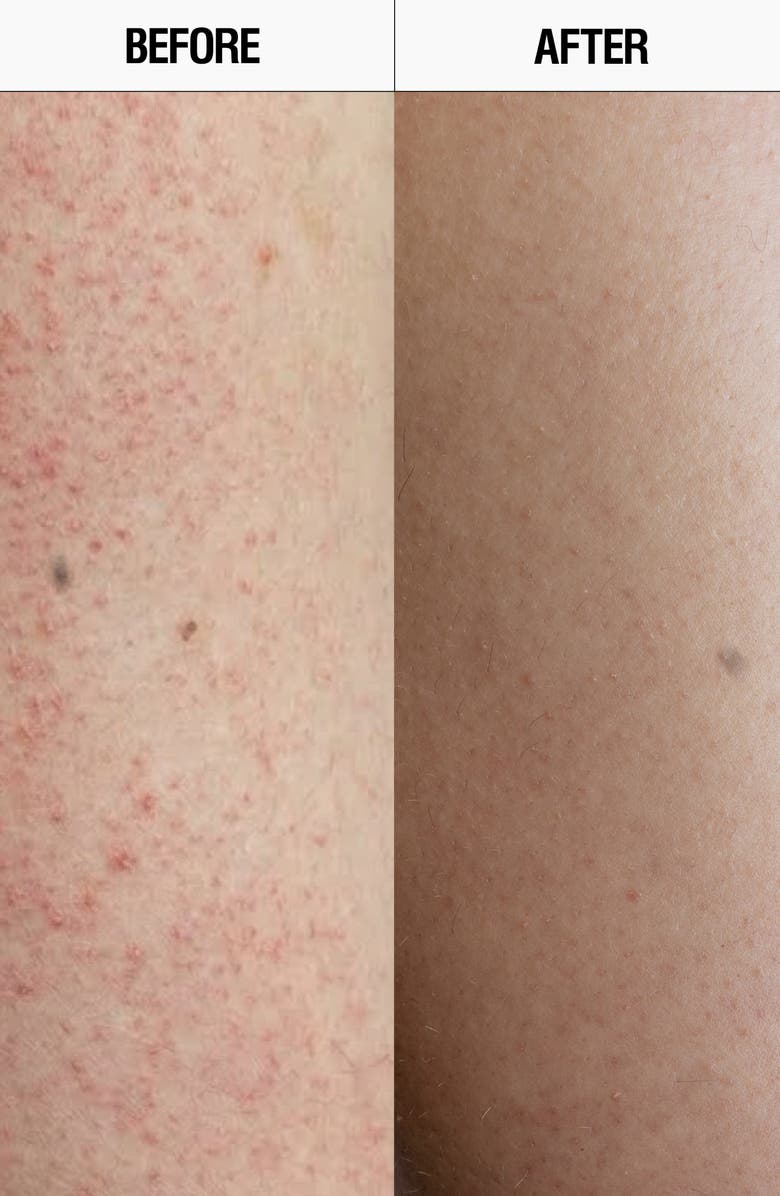 GROWN ALCHEMIST Resurfacing Targeted Body Cleanser, Alternate, color,