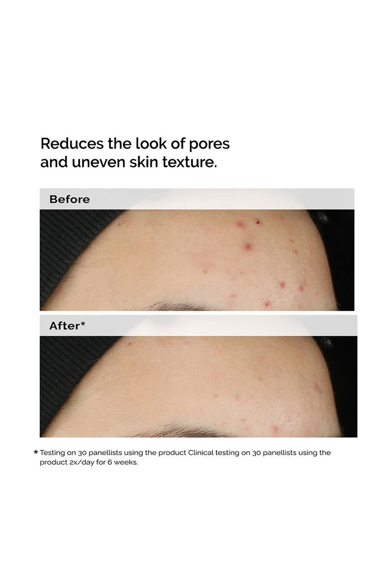 Balancing & Clarifying Serum for Oily Skin, Alternate, color, NO COLOR
