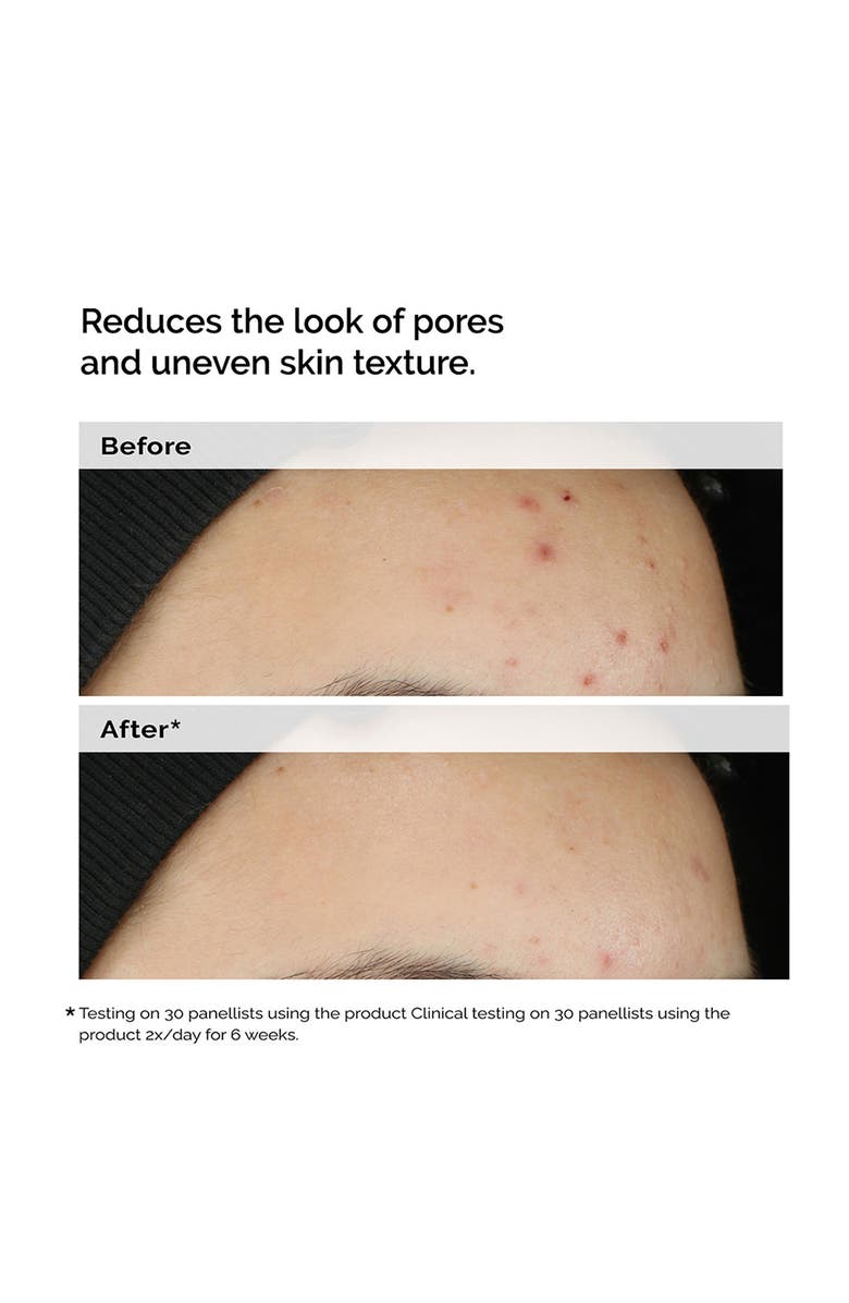 The Ordinary Balancing & Clarifying Serum for Oily Skin, Alternate, color, 