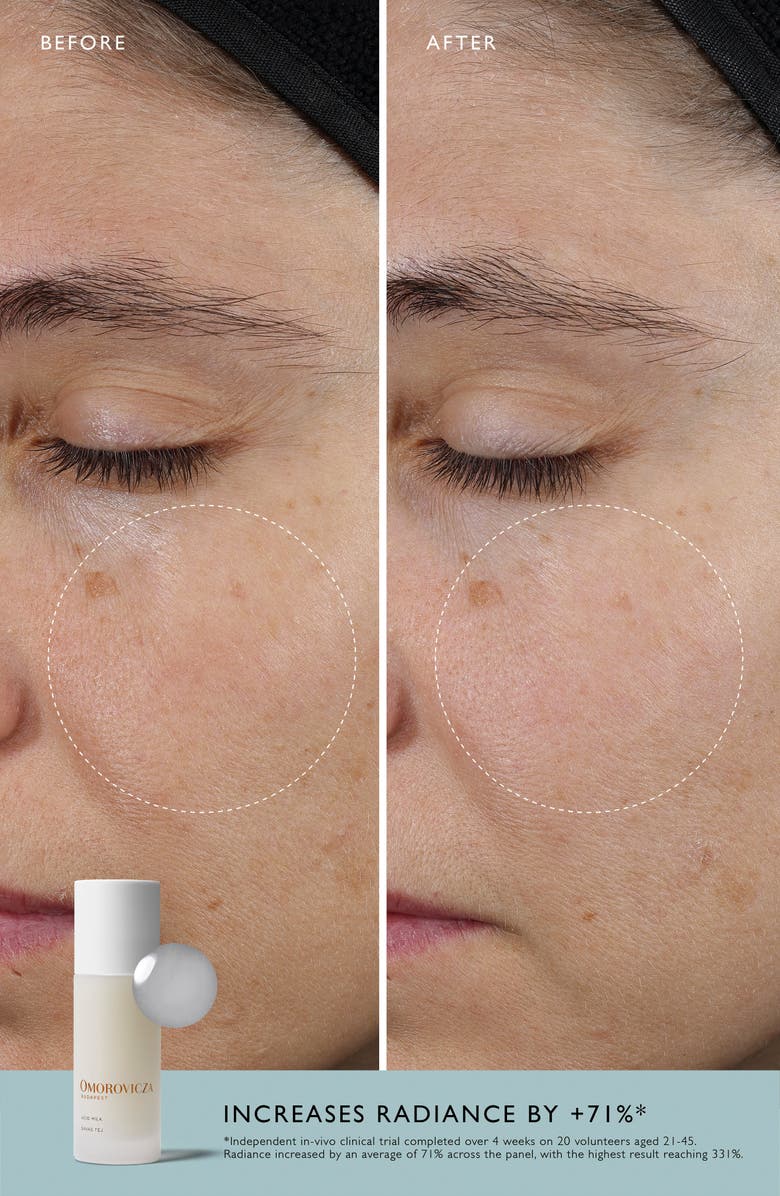 Omorovicza Acid Milk Toner, Alternate, color, 