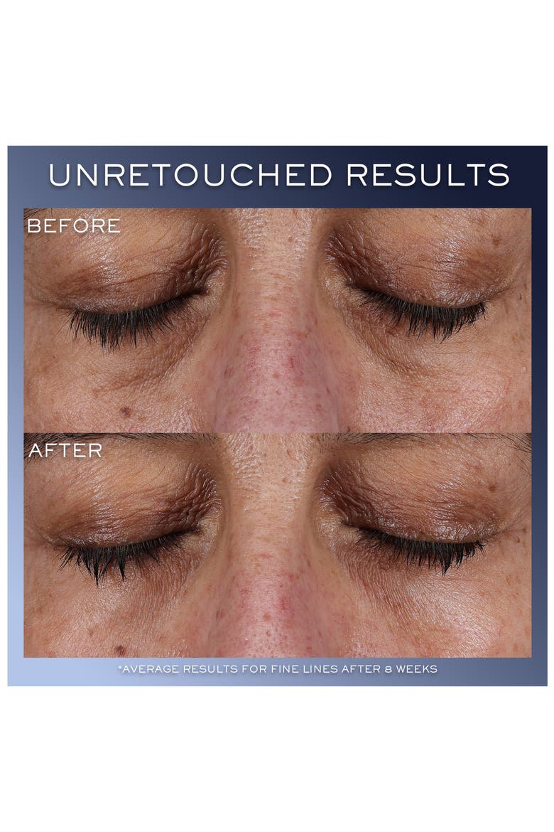 Advanced Génifique Yeux Eye Cream, Alternate, color, NO COLOR