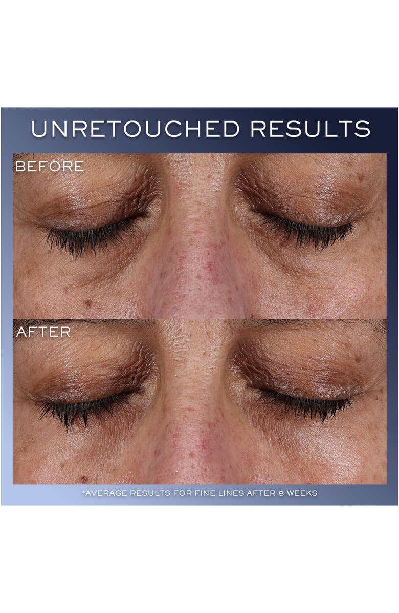 Lancôme Advanced Génifique Yeux Eye Cream, Alternate, color, 