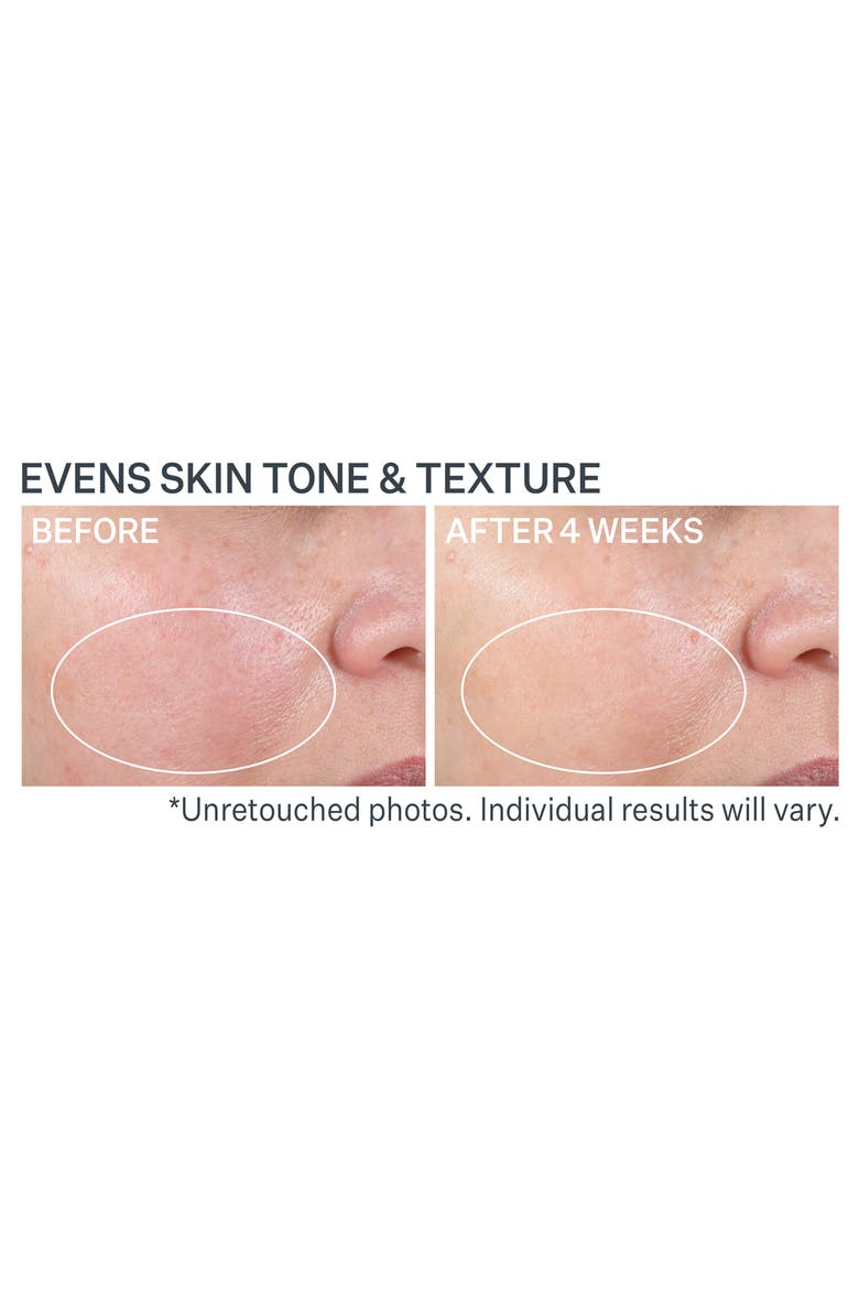 Advanced Retinol Nightly Renewal Moisturizer, Alternate, color, NO COLOR