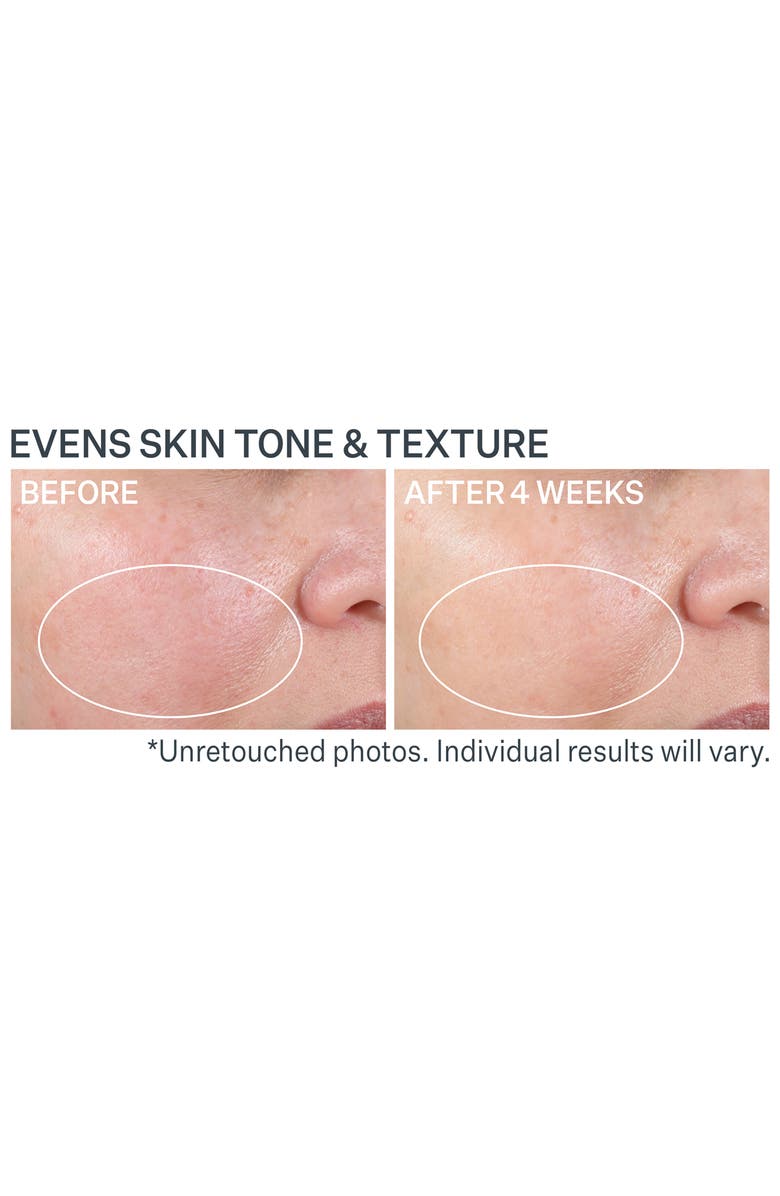 StriVectin<sup>®</sup> Advanced Retinol Nightly Renewal Moisturizer, Alternate, color, 