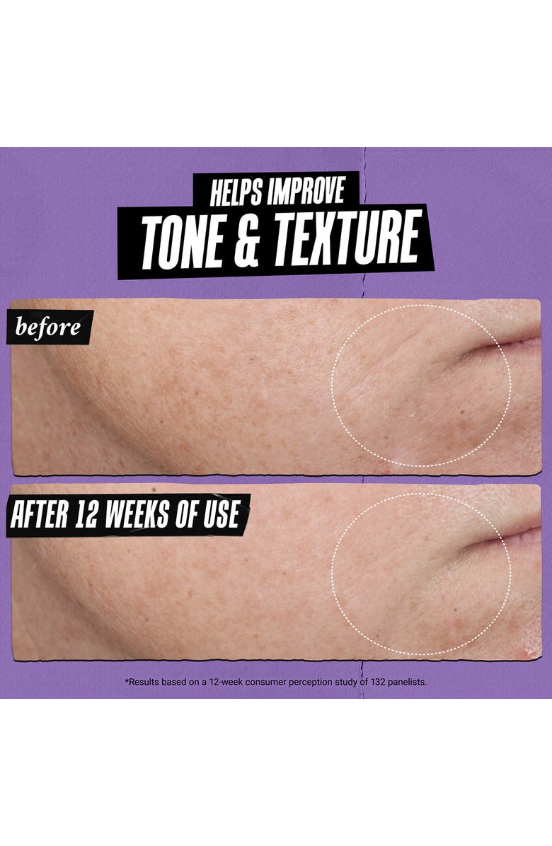 Kiehl's Since 1851 Retinol Skin-Renewing Daily Micro-Dose Facial Serum, Alternate, color, 