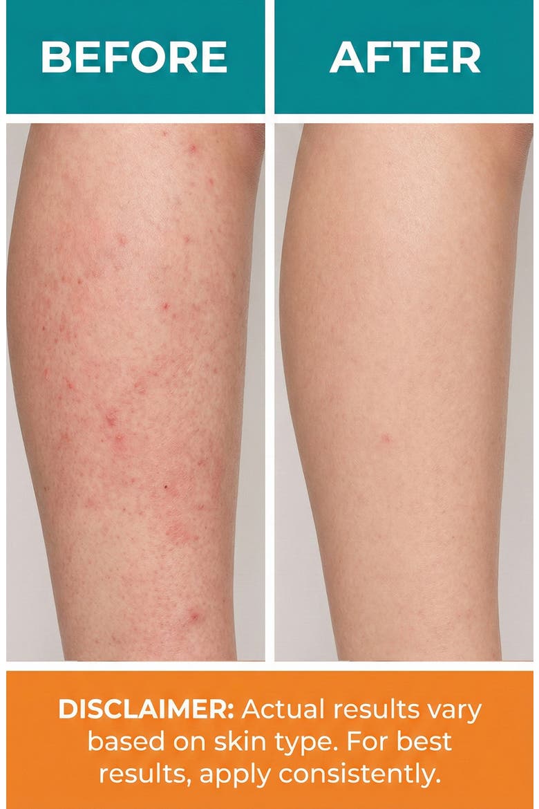 Natural Skin Care, Alternate, color, WHITE
