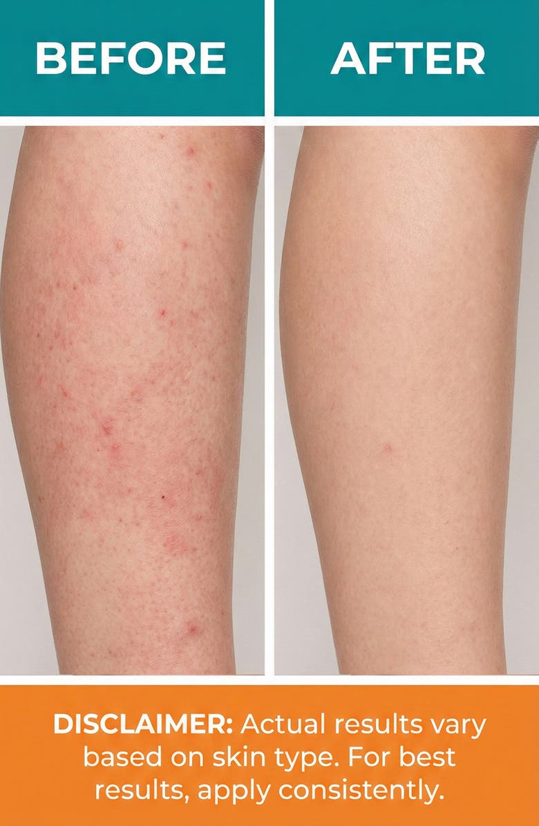 NOLEO Natural Skin Care, Alternate, color, White