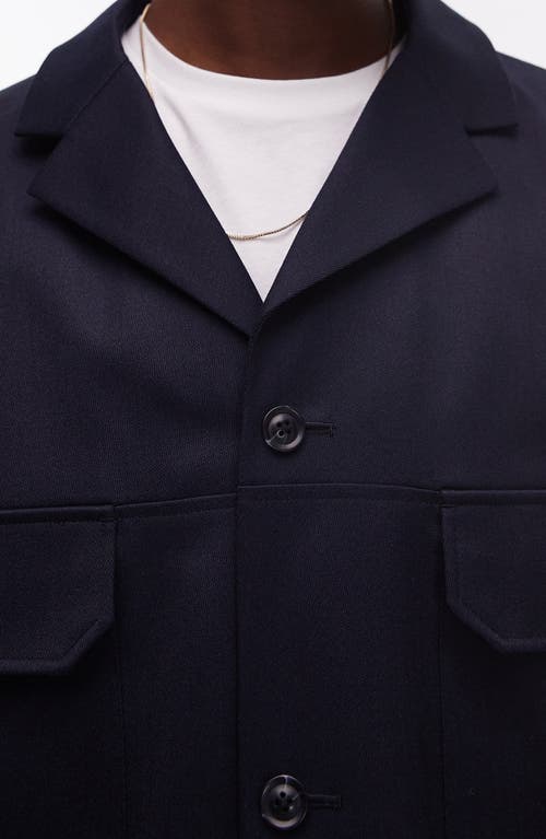 TOPMAN TOPMAN HARRINGTON SUIT JACKET 