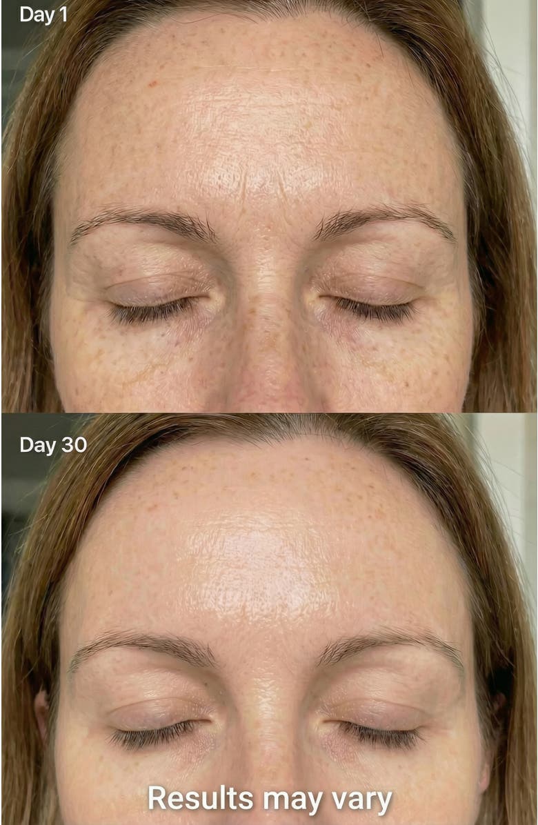 Lovery 7-in-1 Advanced LED Skincare Renewal Wand, Alternate, color, Pink