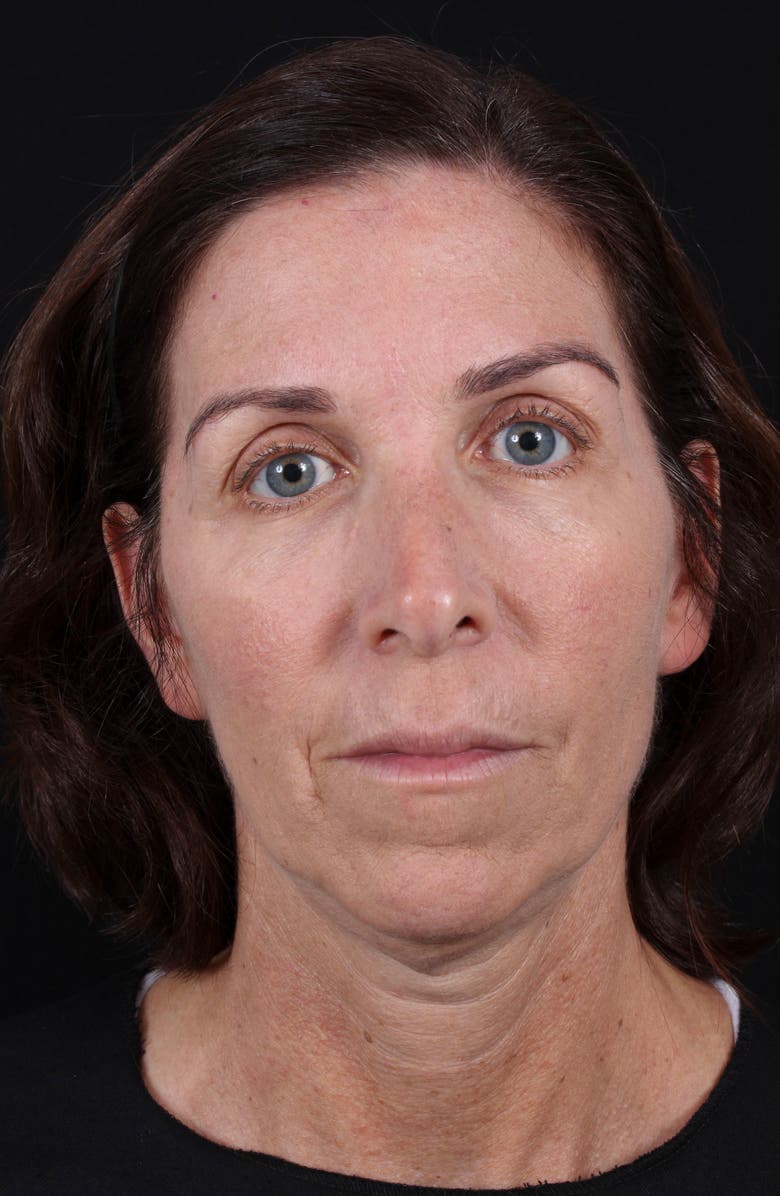 Colorescience <sup>®</sup> All Calm<sup>™</sup> Clinical Redness Corrector SPF 50 PA++++, Alternate, color,