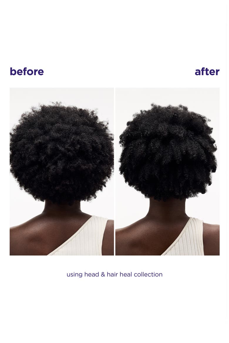 Head & Hair Heal Beauty Box Set, Alternate, color, NO COLOR