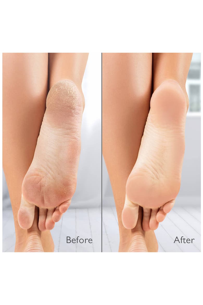 VacuPedi, Alternate, color, WHITE