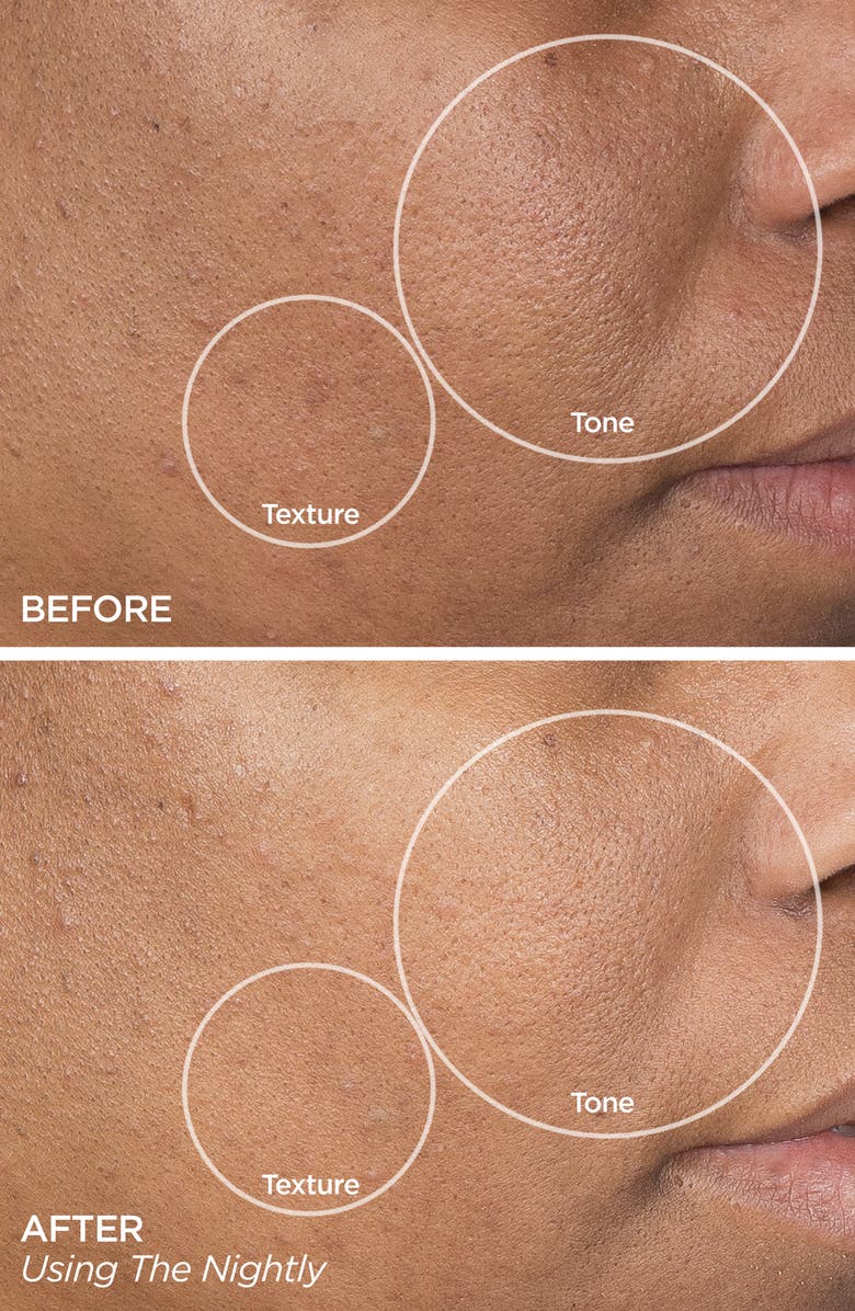 BeautyBio Founders Faves Full Size Set, Alternate, color,