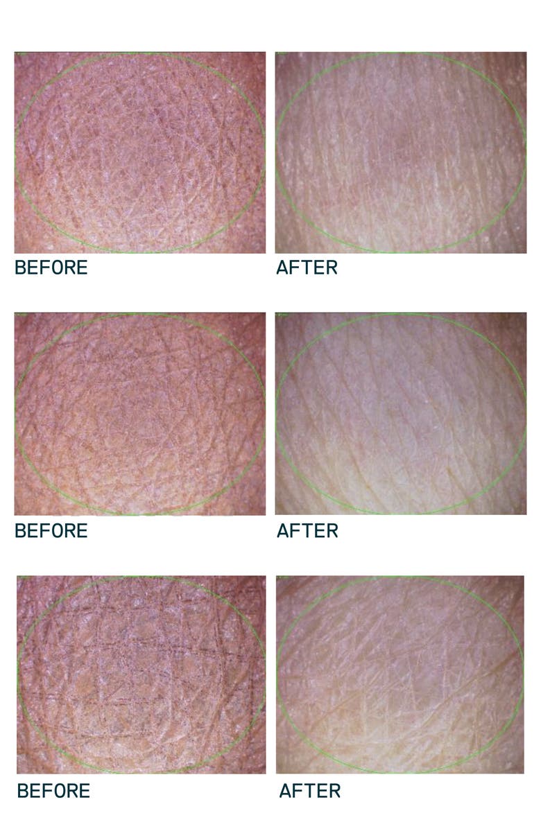 VENN SKINCARE Moisture-Balance All-In-One Face Cleanser, Alternate, color, 