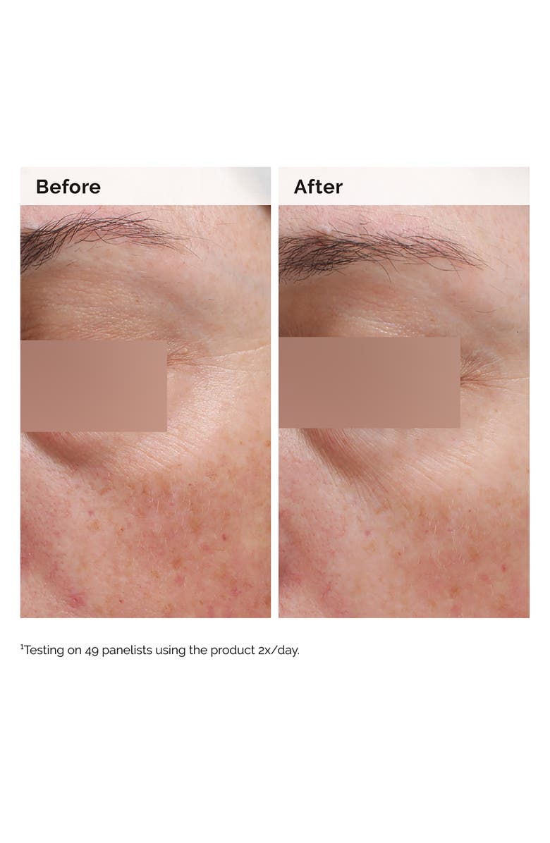 The Ordinary Niacinamide 5% Face and Body Emulsion for Dark Spots & Uneven Tone, Alternate, color, 