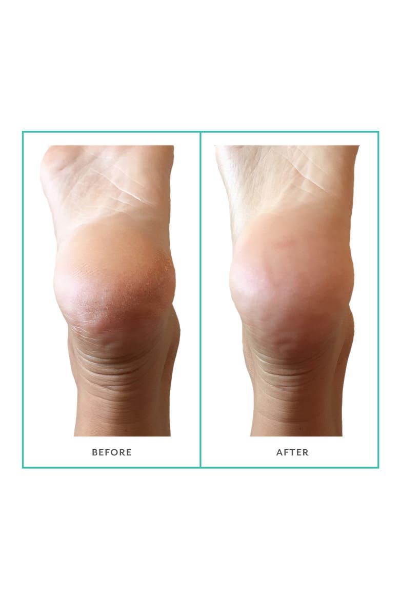 PoshPeel™ Pedi Cure Foot Treatment Peel, Alternate, color, NO COLOR