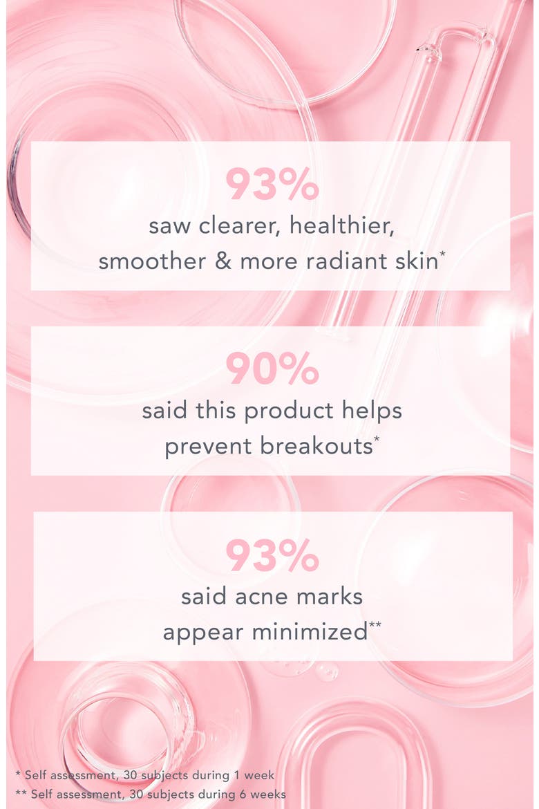 Breakout Star Oil-Free Acne Moisturizer, Alternate, color, NO COLOR