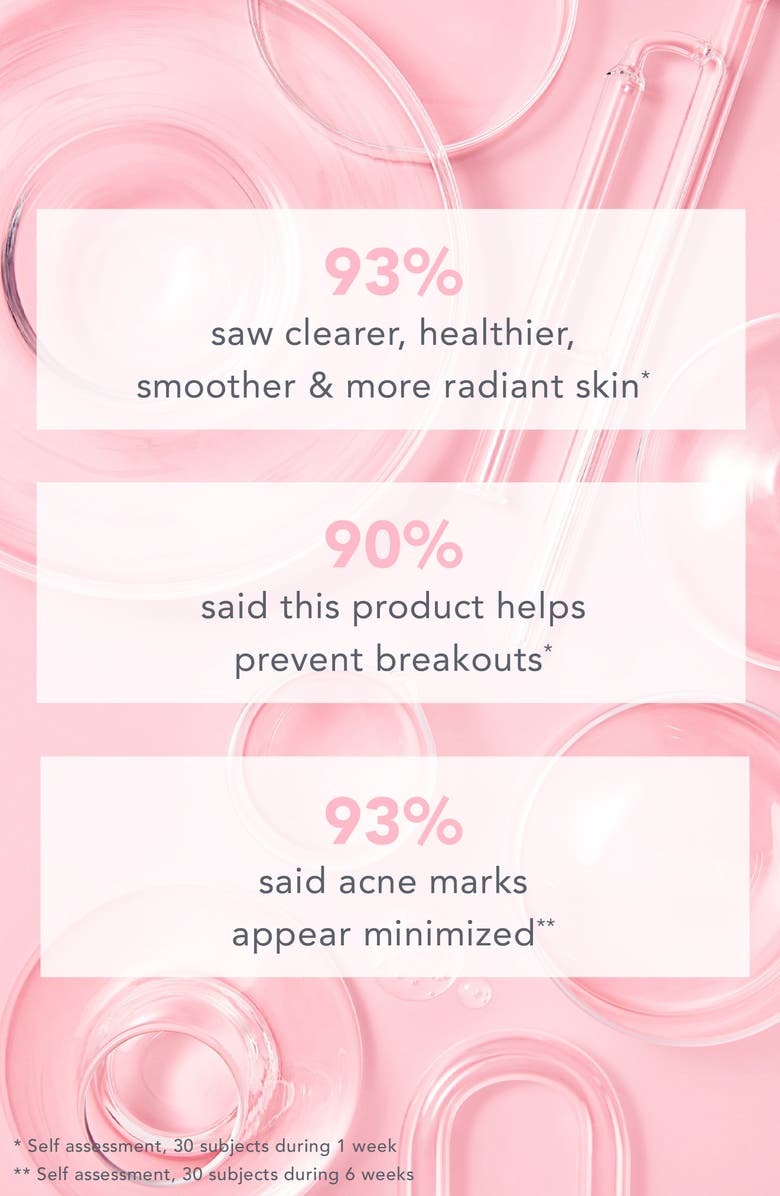 TULA Skincare Breakout Star Oil-Free Acne Moisturizer, Alternate, color,