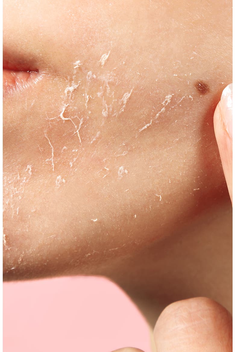Bioactive Rose Gommage Pineapple + Hyaluronic Acid Peel, Alternate, color, NO COLOR