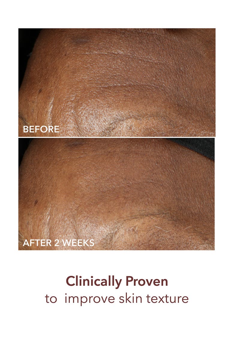 Dr. Dennis Gross Skincare Advanced Retinol + Ferulic Intense Wrinkle Cream, Alternate, color, 