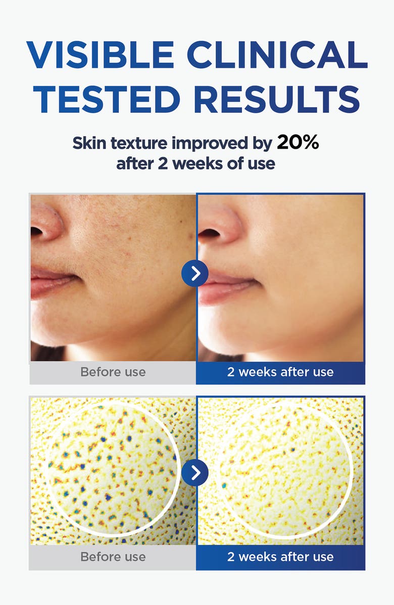 CKD Vita C Teca Toning Shot Serum, Alternate, color, 