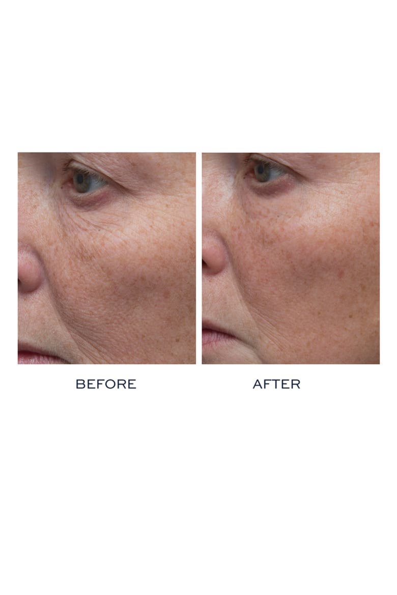 Peptide4 Thousand Flower Mask, Alternate, color, NO COLOR