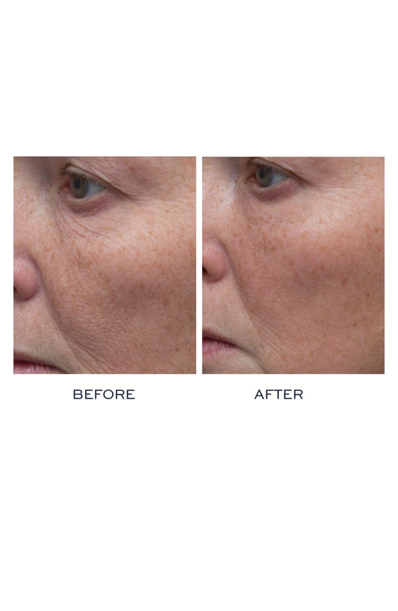 Elemis Peptide4 Thousand Flower Mask, Alternate, color, 