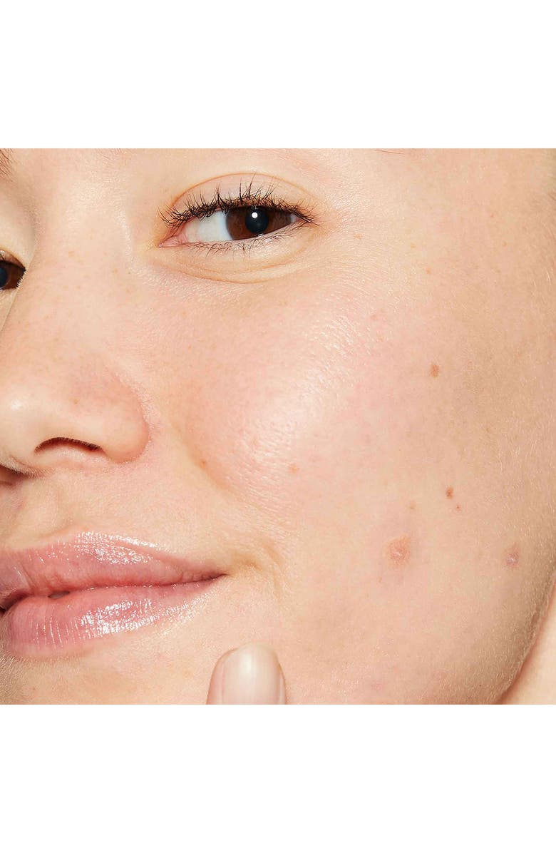 dermalogica<sup>®</sup> Deep Acne Liquid Patch, Alternate, color,