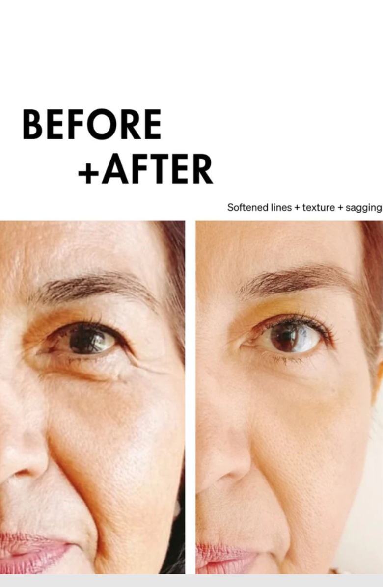 LUCE BEAUTY LUCE 4T Therapy Microcurrent Wand - 2nd Gen, Alternate, color,