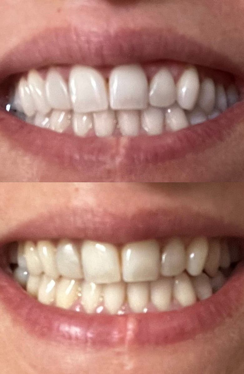 SNOW Advanced Teeth Whitening LED Toothbrush, Alternate, color, 