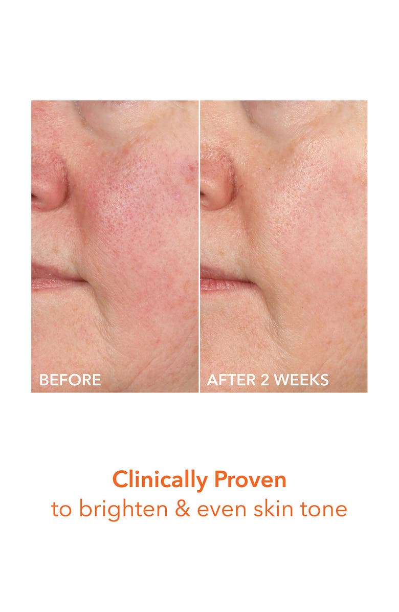 Dr. Dennis Gross Skincare Vitamin C Lactic 15% Firm & Bright Serum, Alternate, color, 