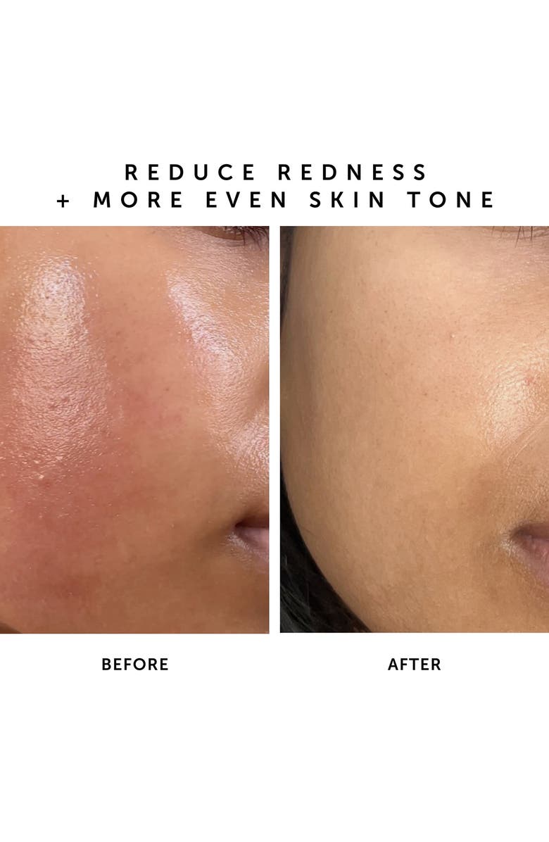 Herbivore Botanicals NOVA 15% Vitamin C + Turmeric Brightening Serum, Alternate, color,