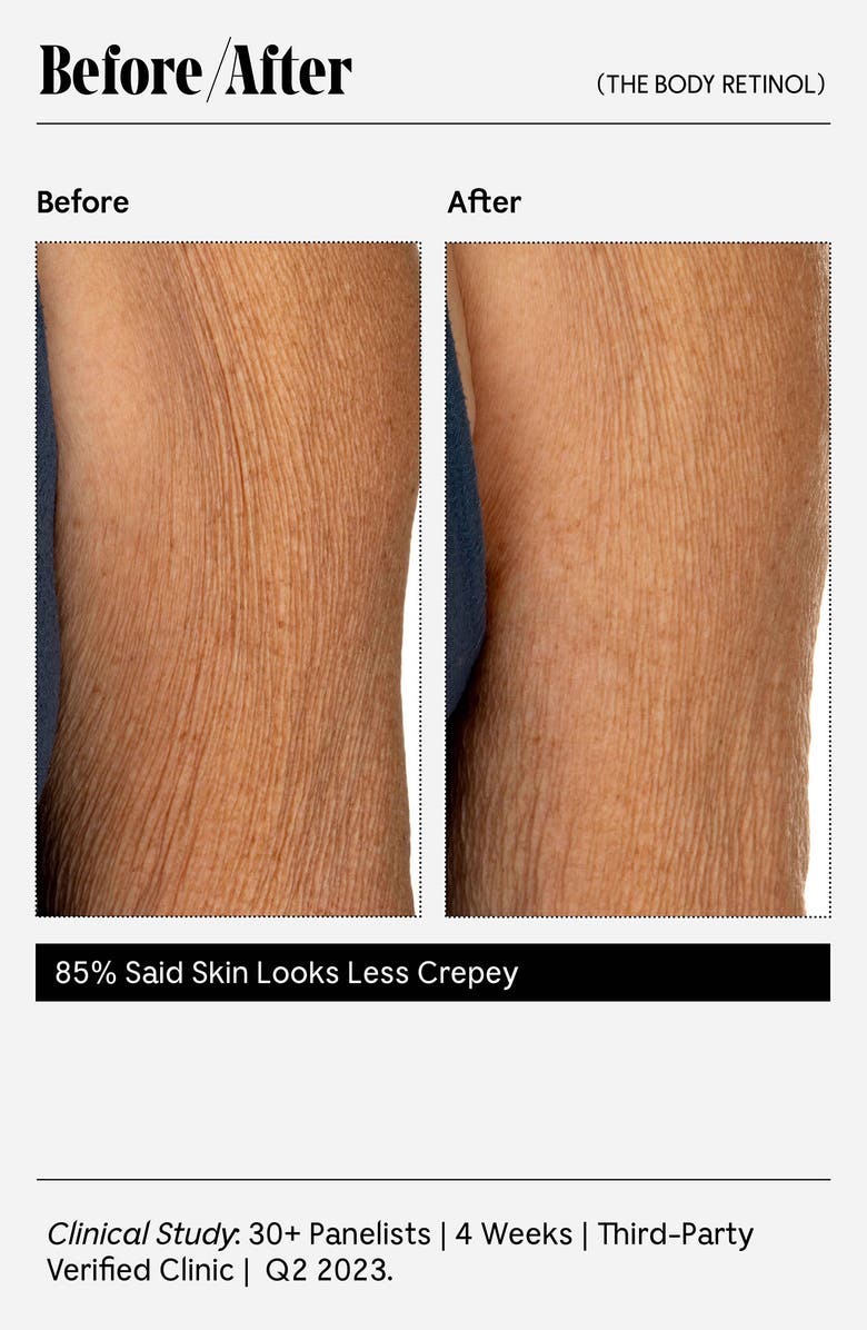 Nécessaire The Body Retinol, Alternate, color,