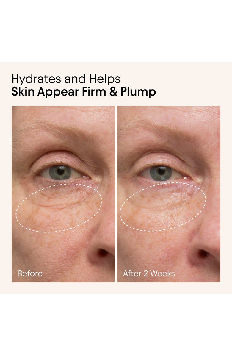 Alpyn Firming Serum with Niacinamide & Nettle, Alternate, color,