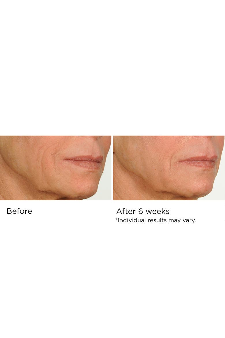 Night Therapy Serum 1oz, Alternate, color, None