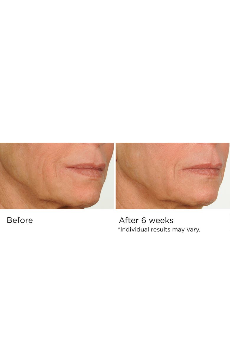 Dr. Nassif Skincare Night Therapy Serum 1oz, Alternate, color, NO COLOR