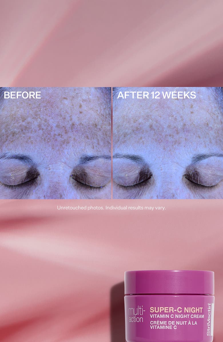 StriVectin<sup>®</sup> Multi-Action Trio: Brighten & Restore $98 Value, Alternate, color,