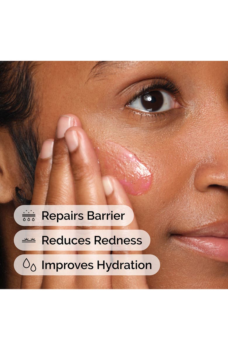 The Ordinary Soothing & Barrier Support Serum & Keychain Pouch Set, Alternate, color,