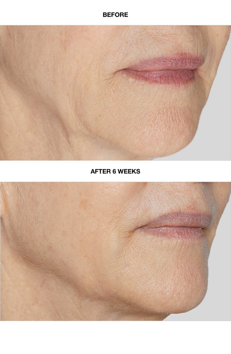 Angela Caglia Cell Forté Serum with BIOMSC<sup>™</sup>, Alternate, color,