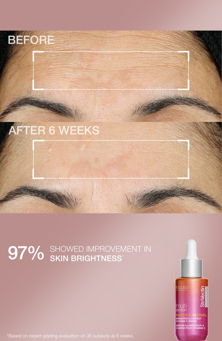 StriVectin<sup>®</sup> Skin Minis Skin Care Set $78 Value, Alternate, color, 