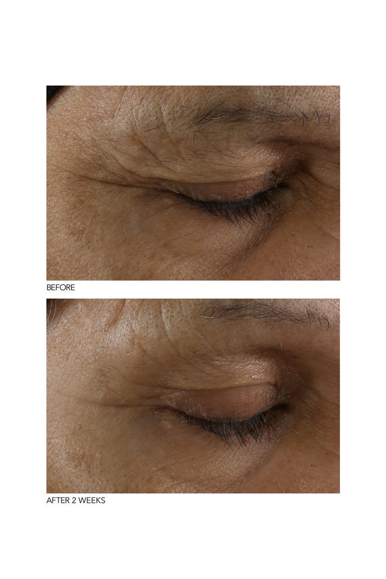 B3Adaptive SuperFoods™ Stress SOS Eye Cream, Alternate, color, NO COLOR