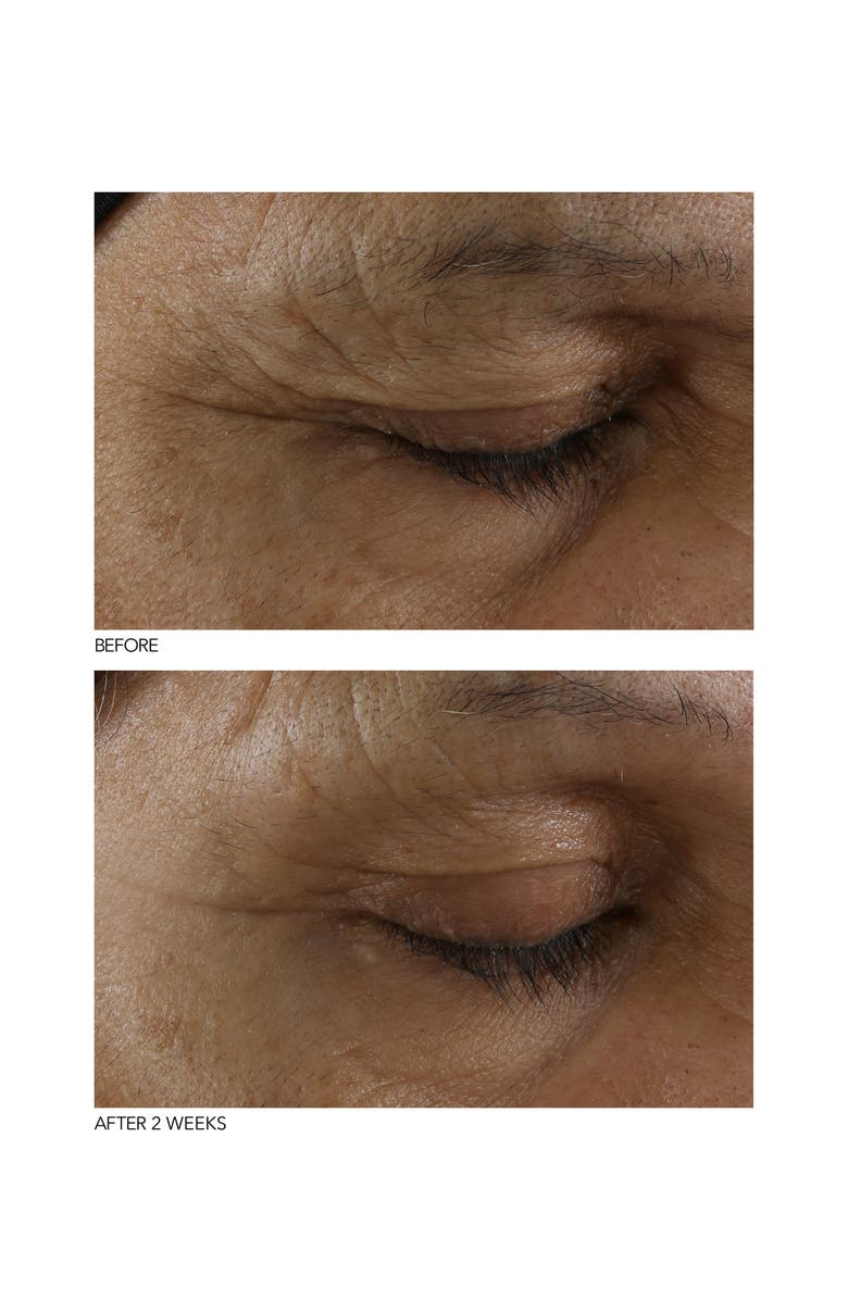 Dr. Dennis Gross Skincare B3Adaptive SuperFoods<sup>™</sup> Stress SOS Eye Cream, Alternate, color, 