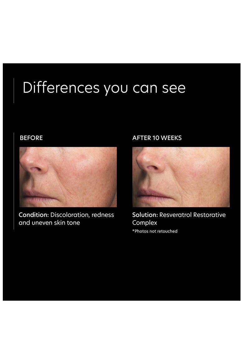 Resveratrol Restorative Complex Serum, Alternate, color, NO COLOR