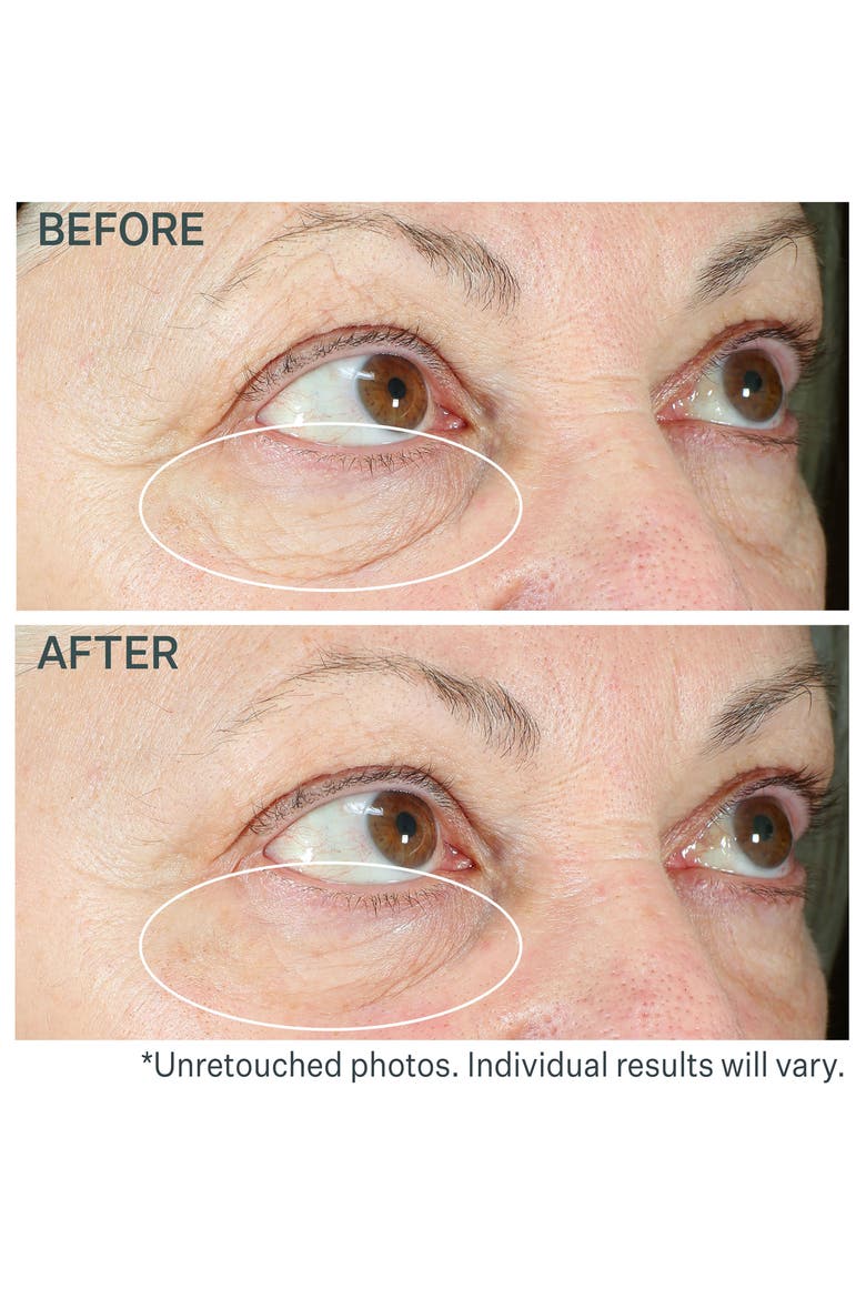 Hyperlift Eye™ Instant Eye Fix Tightening Treatment, Alternate, color, NO COLOR